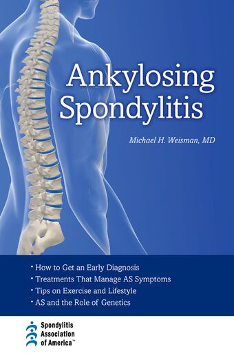 Ankylosing Spondylitis book cover
