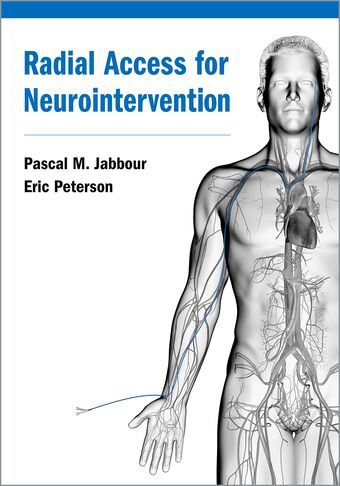 Radial Access for Neurointervention book cover