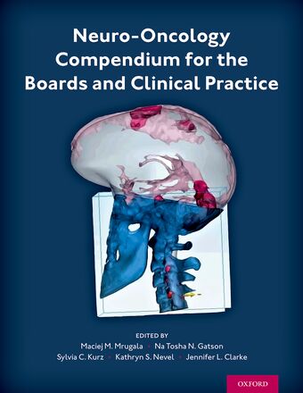 Neuro-Oncology Compendium for the Boards and Clinical Practice book cover