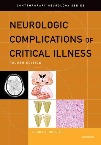 Neurologic Complications of Critical Illness book cover