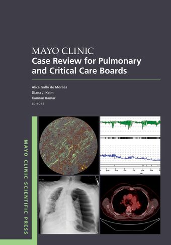 Mayo Clinic Case Review for Pulmonary and Critical Care Boards book cover