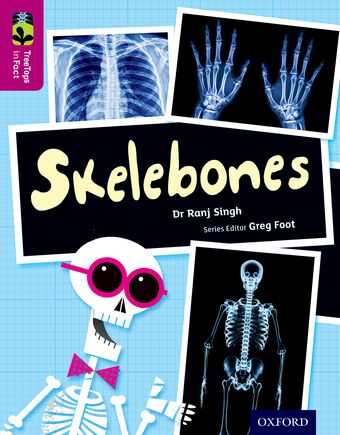 TreeTops InFact Level 10 Skelebones book cover