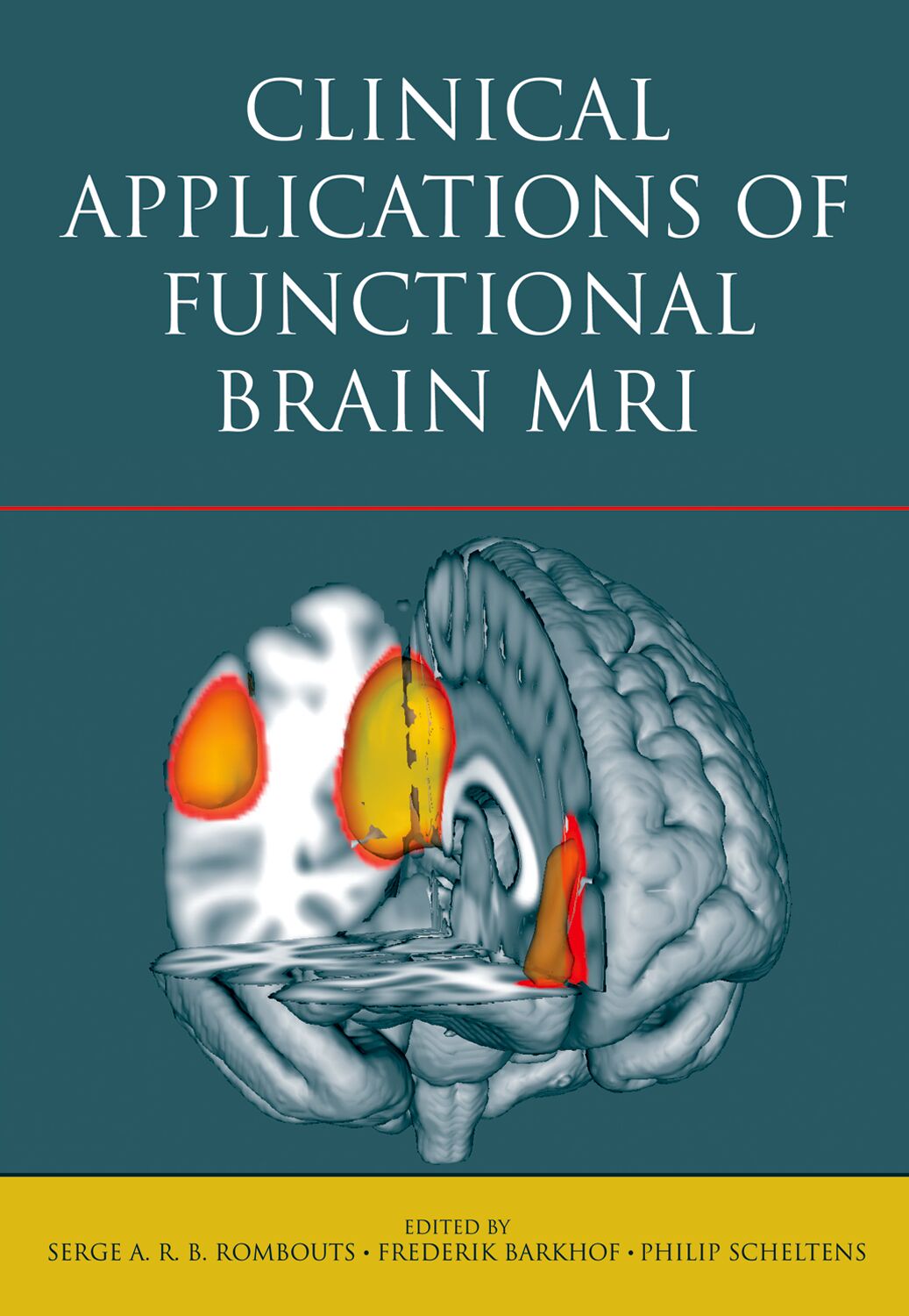 Clinical Applications of Functional Brain MRI book cover