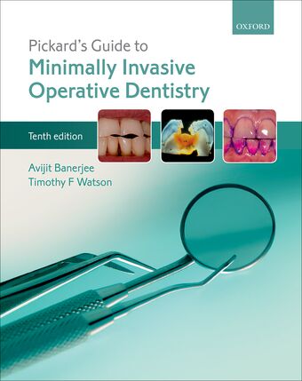 Pickard's Guide to Minimally Invasive Operative Dentistry book cover
