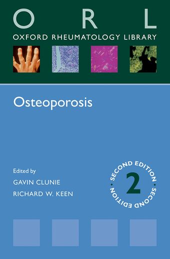 Osteoporosis book cover