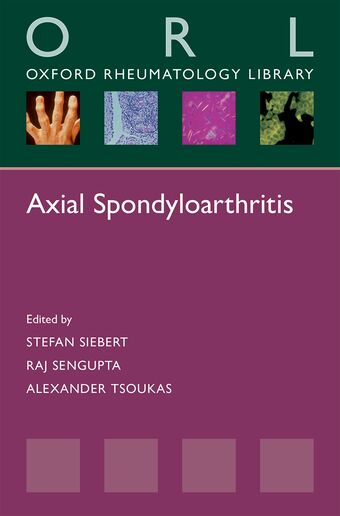 Axial Spondyloarthritis book cover