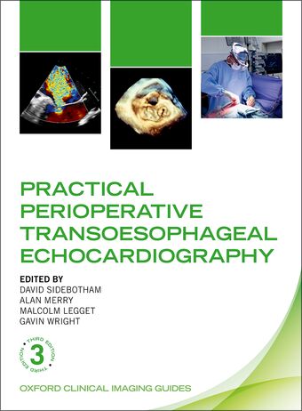 Practical Perioperative Transoesophageal Echocardiography book cover