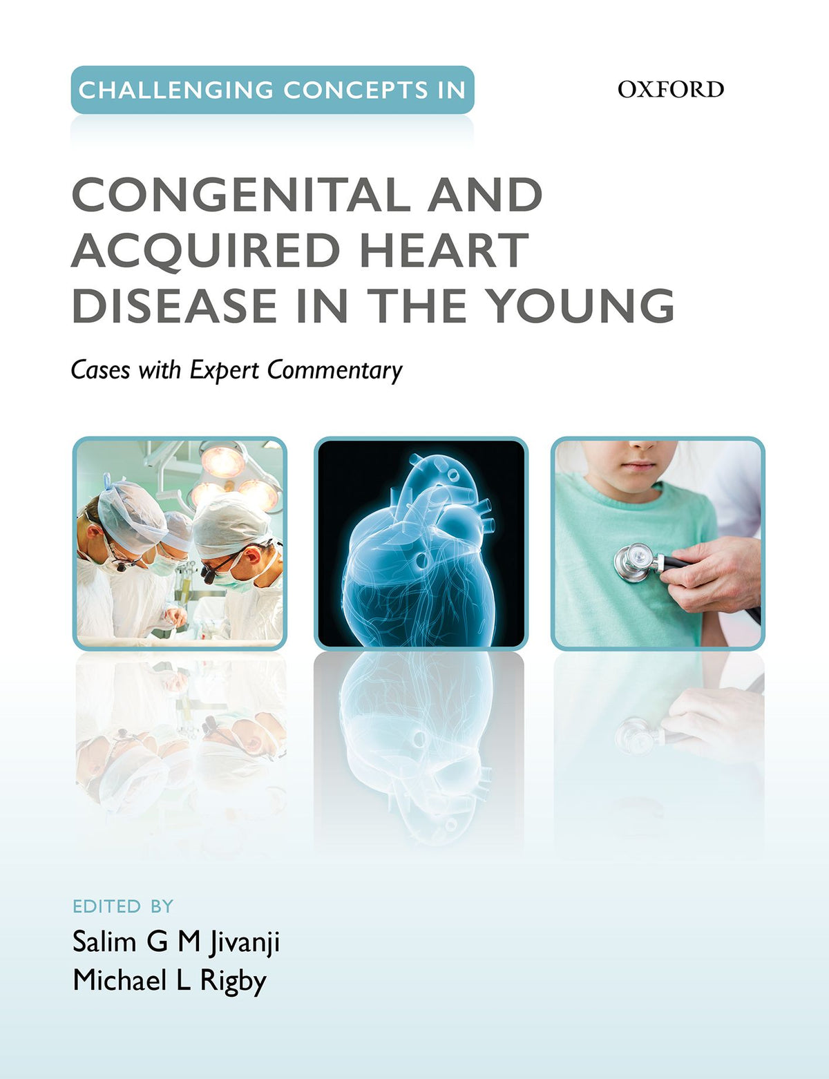 Challenging Concepts in Congenital and Acquired Heart Disease in the Young book cover