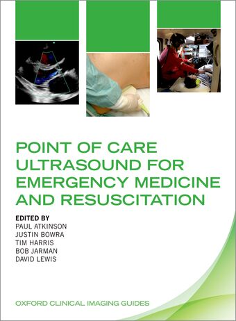 Point of Care Ultrasound for Emergency Medicine and Resuscitation book cover