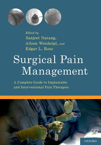 Surgical Pain Management book cover