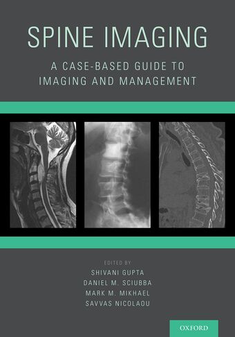 Spine Imaging book cover