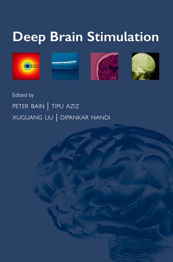 Deep Brain Stimulation book cover
