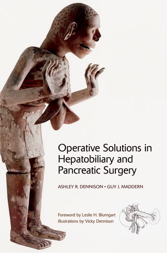 Operative Solutions in Hepatobiliary and Pancreatic Surgery book cover