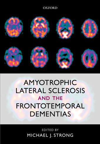 Amyotrophic Lateral Sclerosis and the Frontotemporal Dementias book cover