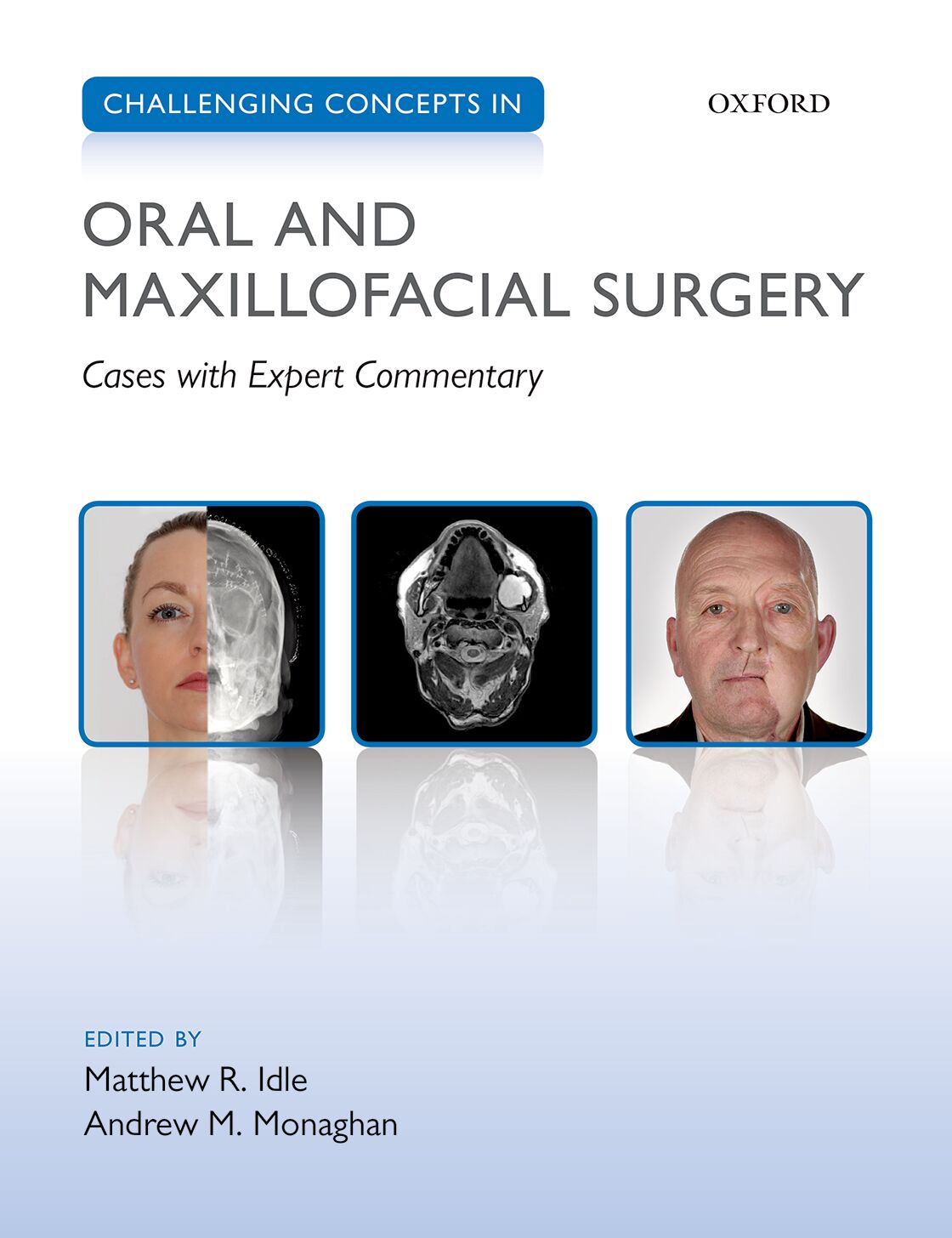 Challenging Concepts in Oral and Maxillofacial Surgery book cover