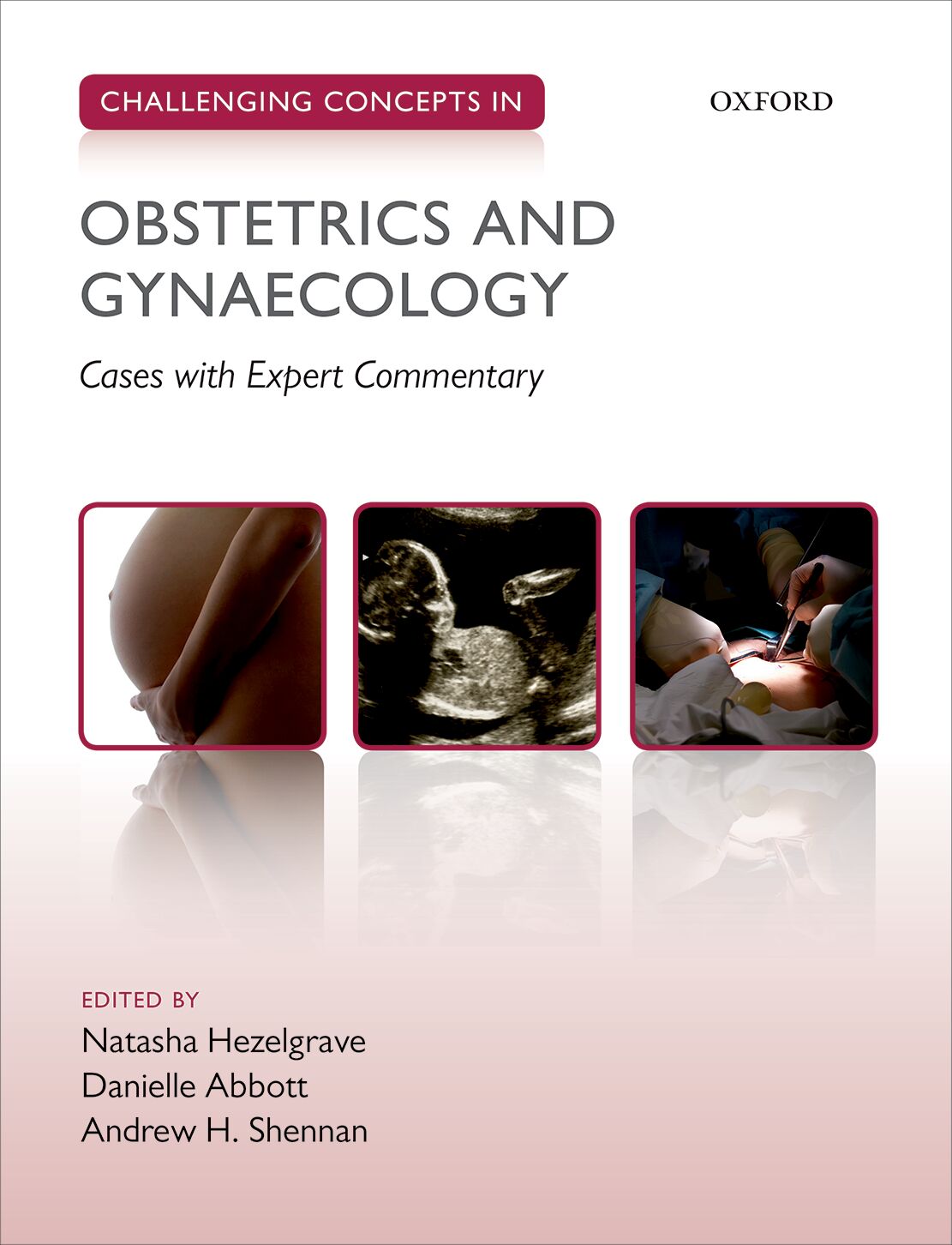 Challenging Concepts in Obstetrics and Gynaecology book cover