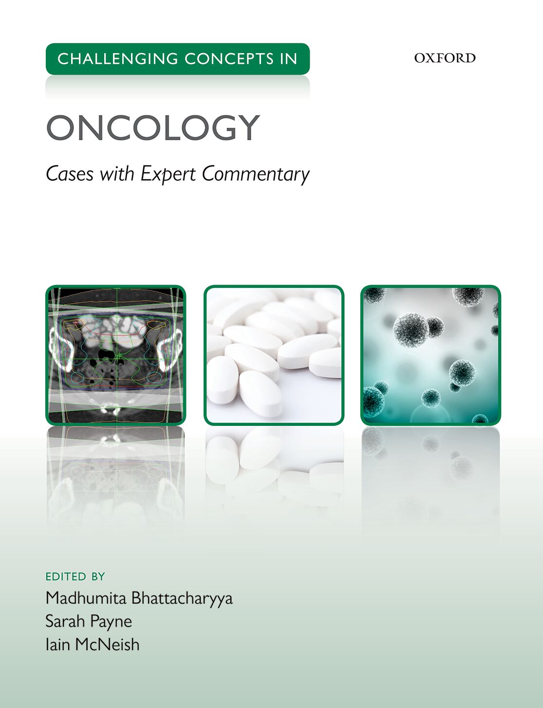 Challenging Concepts in Oncology book cover