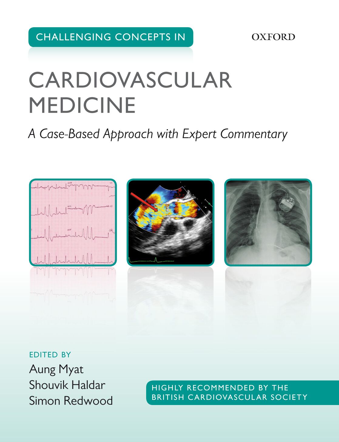 Challenging Concepts in Cardiovascular Medicine book cover
