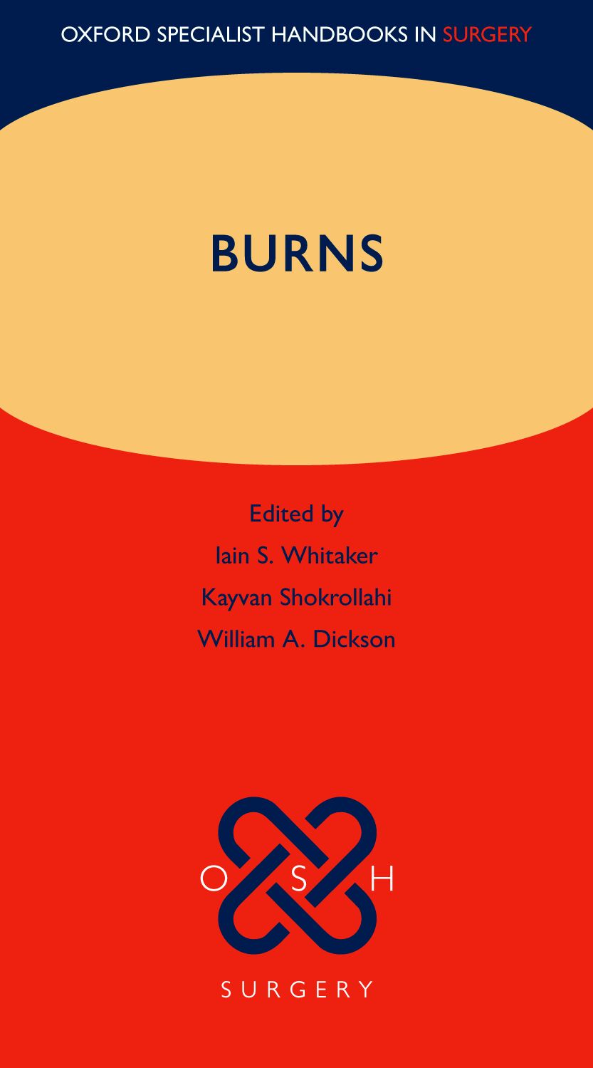 Burns (OSH Surgery) book cover