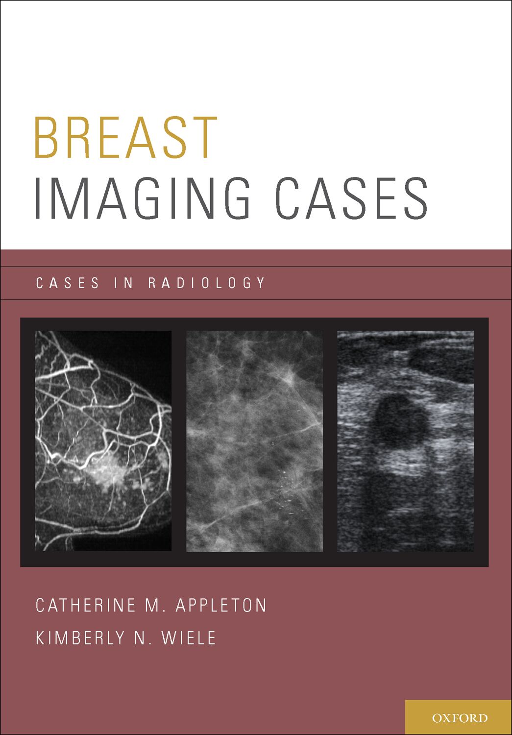 Breast Imaging Cases book cover