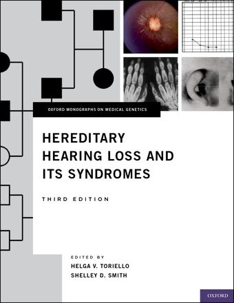Hereditary Hearing Loss and Its Syndromes book cover
