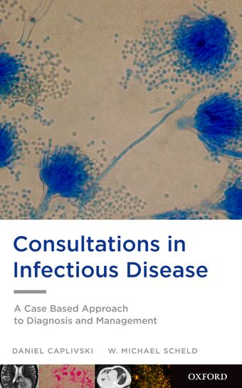 Consultations in Infectious Disease book cover