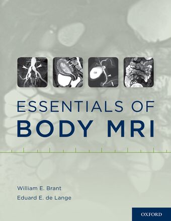 Essentials of Body MRI book cover