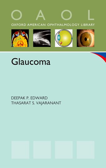 Glaucoma book cover