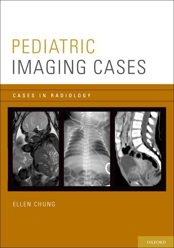 Pediatric Imaging Cases book cover