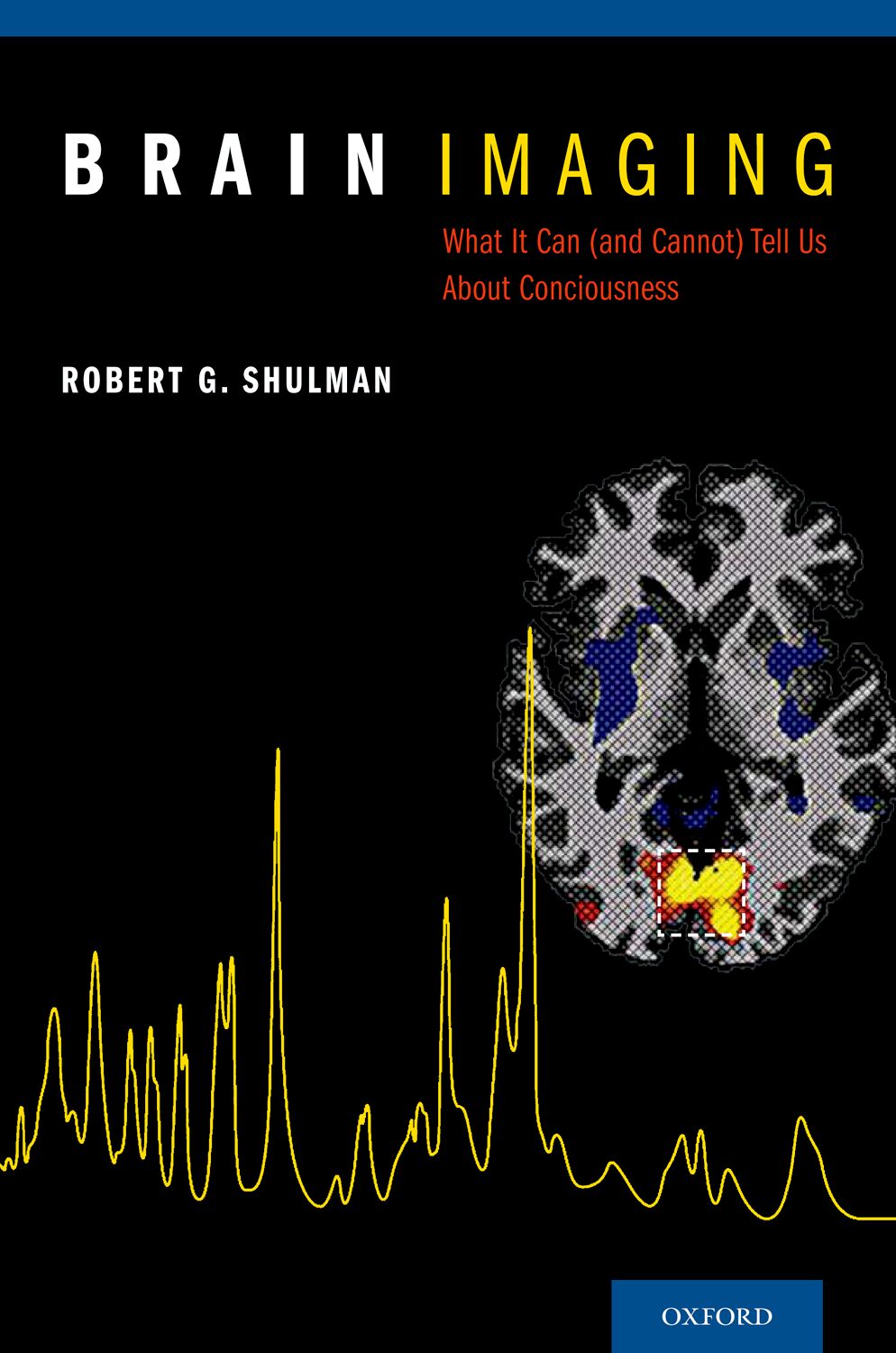 Brain Imaging book cover