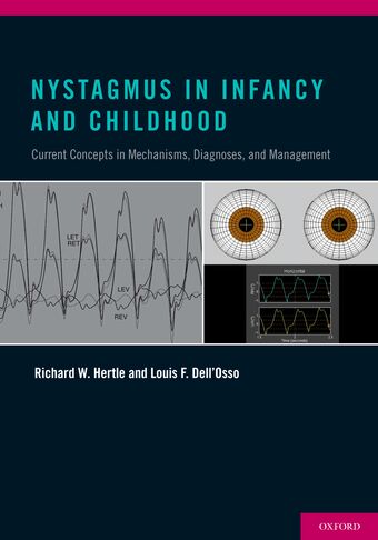 Nystagmus in Infancy and Childhood book cover