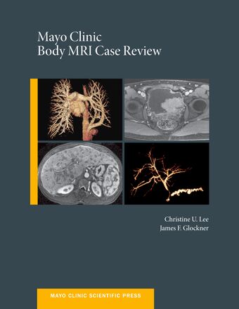 Mayo Clinic Body MRI Case Review book cover