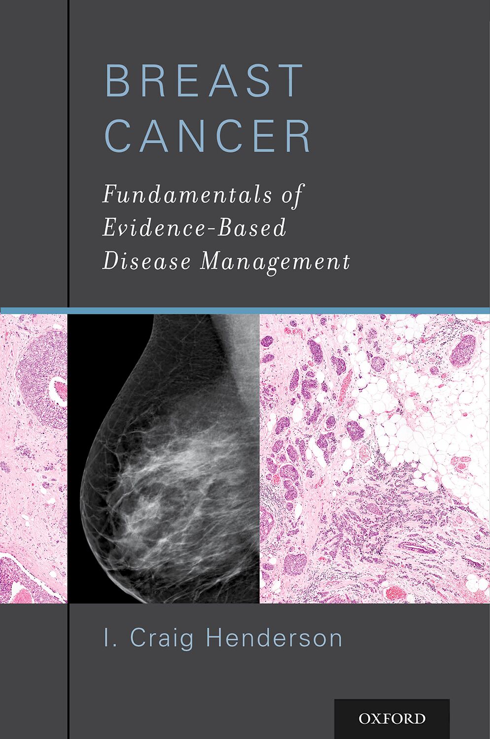Breast Cancer book cover