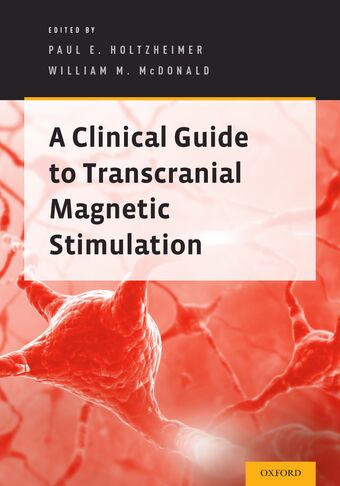 A Clinical Guide to Transcranial Magnetic Stimulation book cover