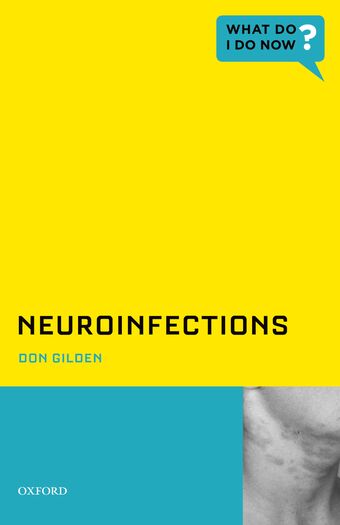 Neuroinfections book cover