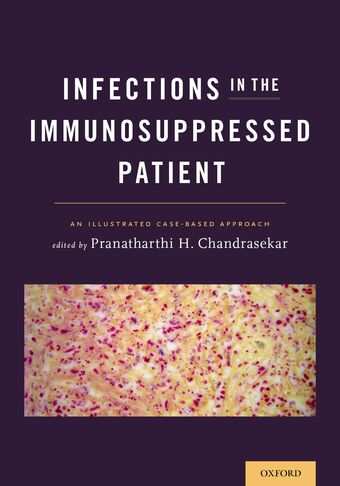 Infections in the Immunosuppressed Patient book cover