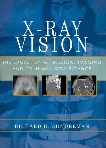X Ray Vision book cover