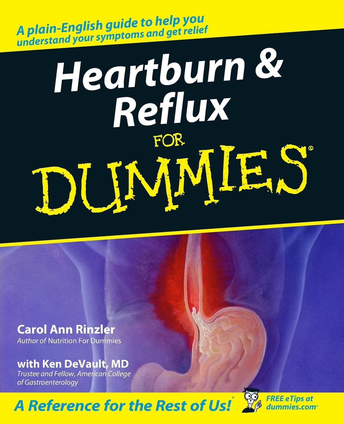 Heartburn and Reflux For Dummies cover