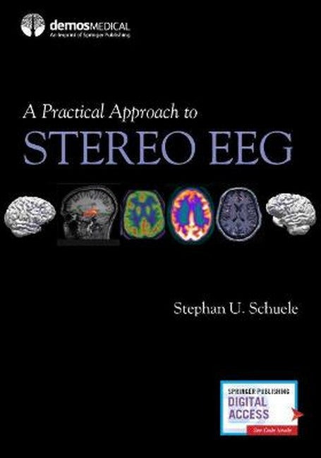 A Practical Approach to Stereo EEG cover