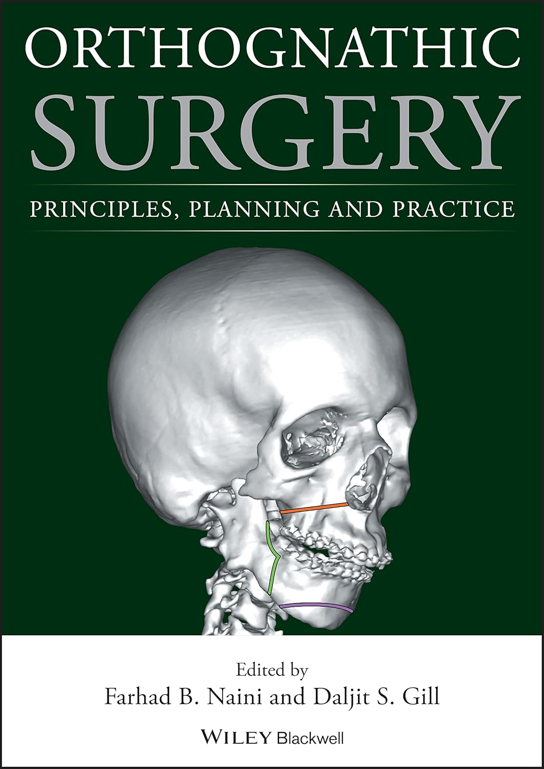 Orthognathic Surgery: Principles, Planning and Practice cover