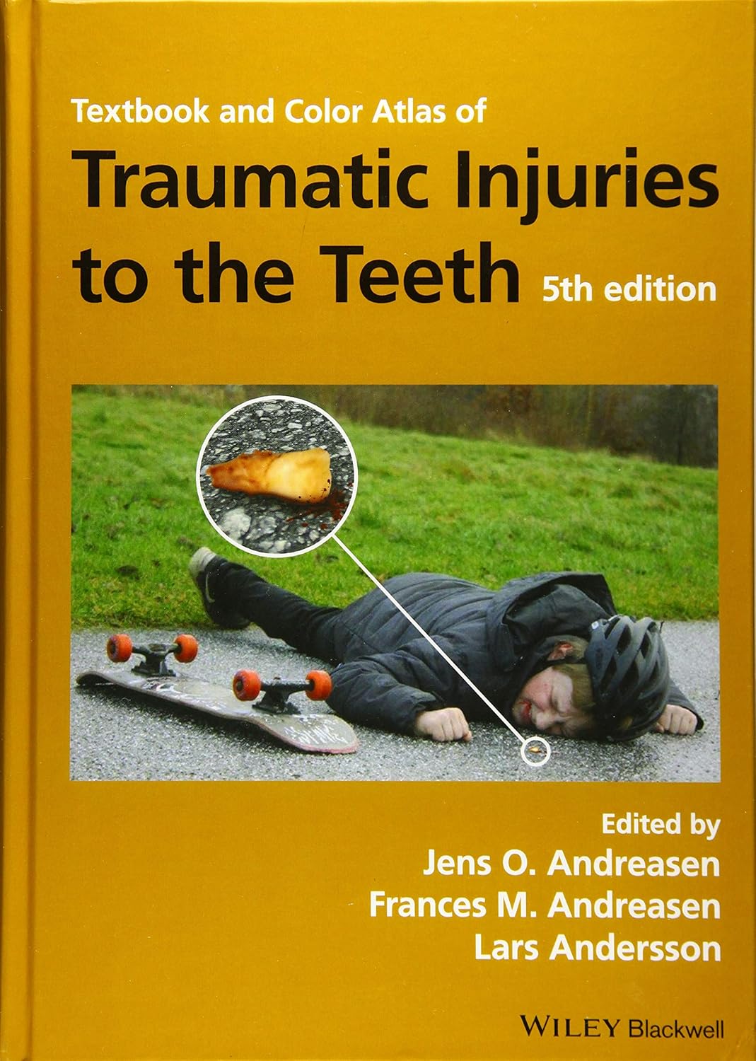 Textbook and Color Atlas of Traumatic Injuries to the Teeth cover
