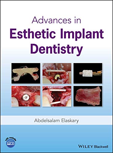Advances in Esthetic Implant Dentistry cover