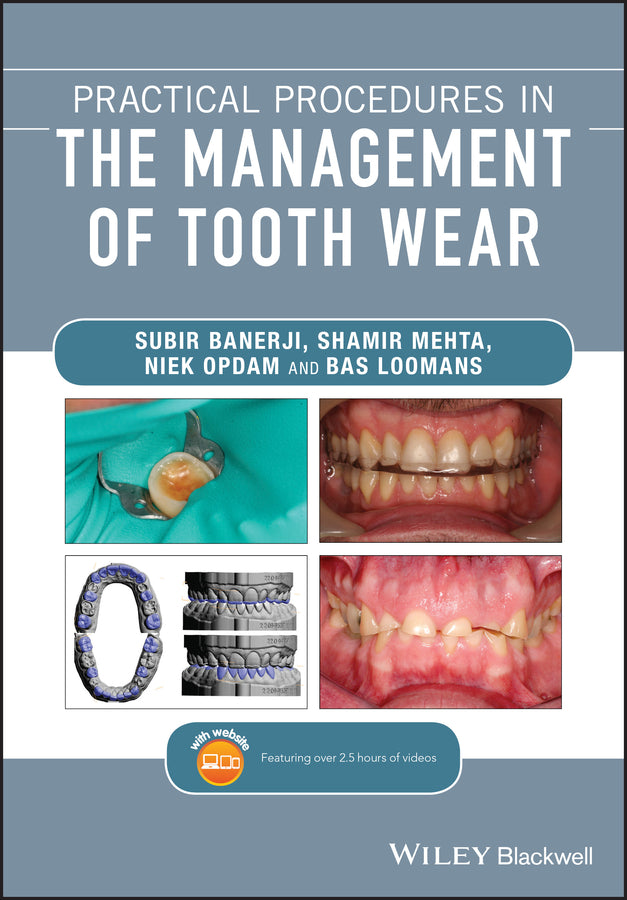 Practical Procedures in the Management of Tooth Wear cover
