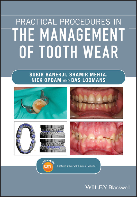 Practical Procedures in the Management of Tooth Wear cover