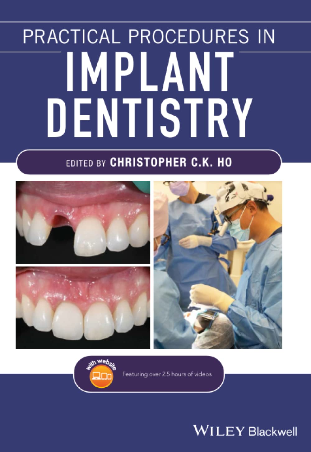 Practical Procedures in Implant Dentistry cover