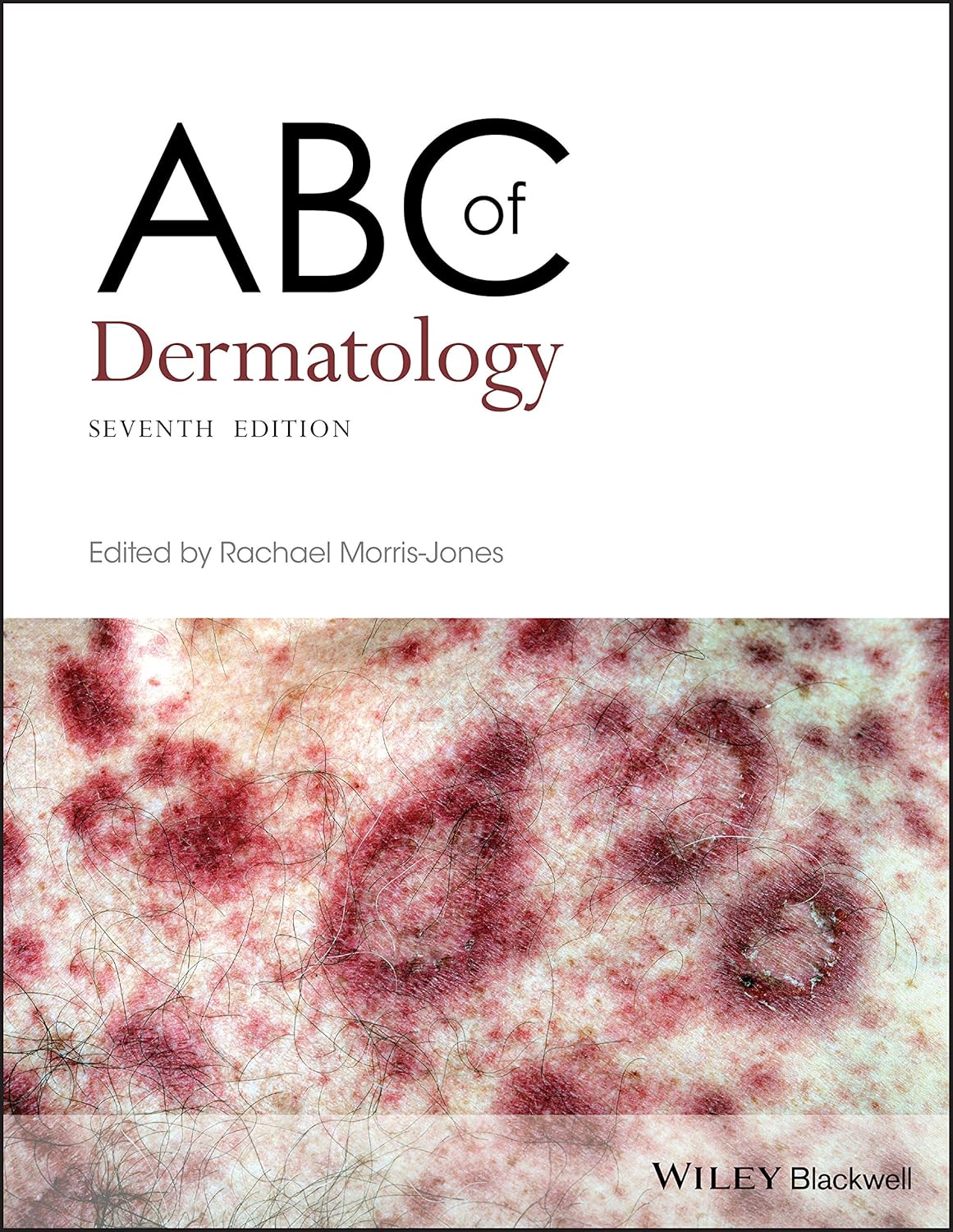 ABC Series cover