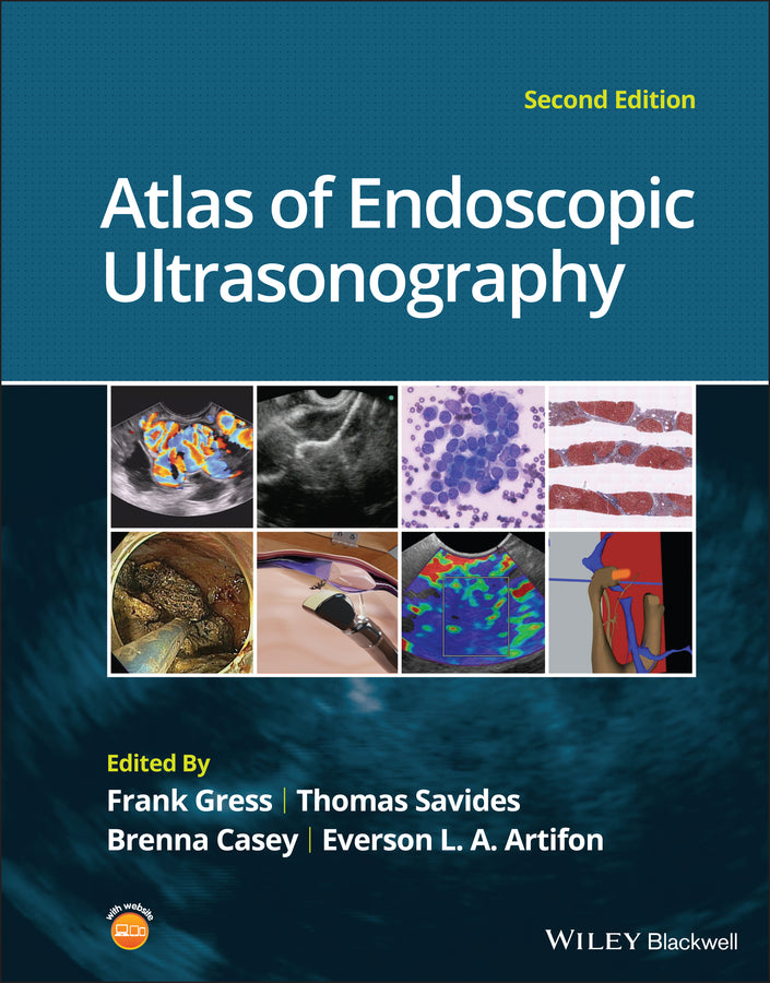 Atlas of Endoscopic Ultrasonography cover