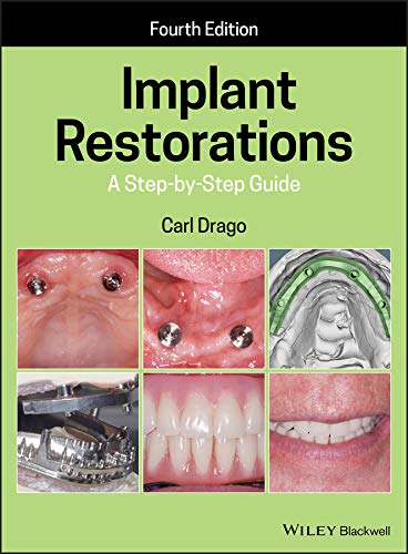 Implant Restorations: A Step-by-Step Guide cover
