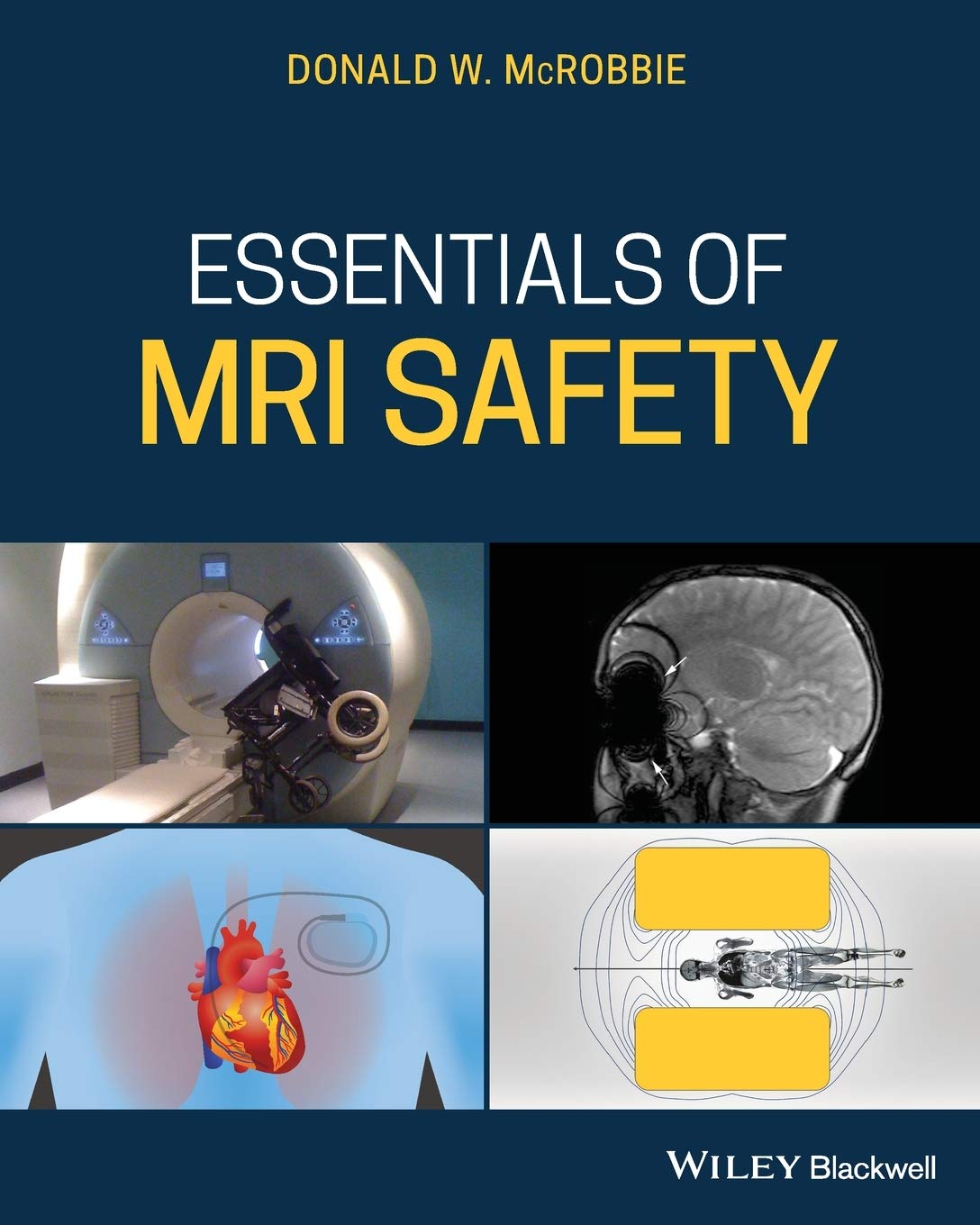Essentials of MRI Safety cover