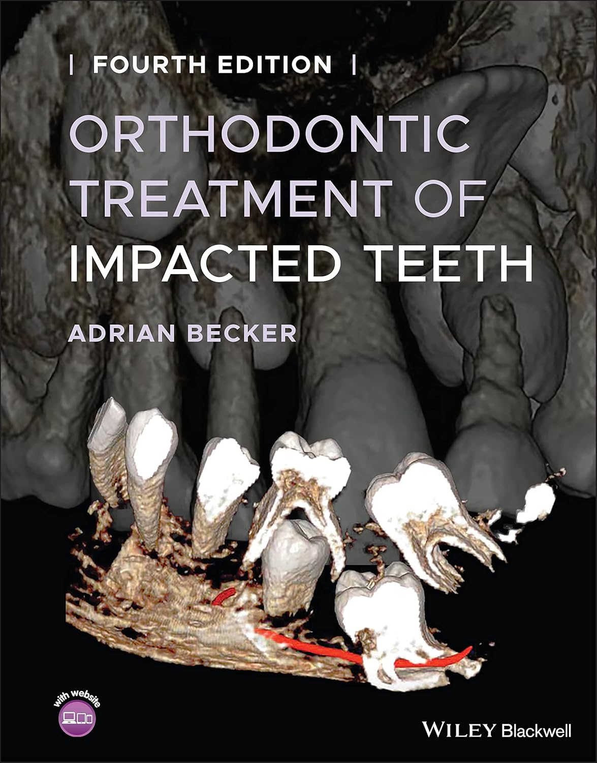 Orthodontic Treatment of Impacted Teeth cover